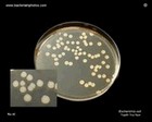 Escherichia coli 2